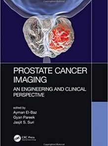 Prostate Cancer Imaging: An Engineering and Clinical Perspective PDF