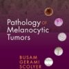 Pathology of Melanocytic Tumors