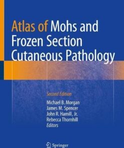 Atlas of Mohs and Frozen Section Cutaneous Pathology 2nd ed. 2018 Edition