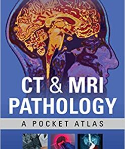 CT & MRI Pathology: A Pocket Atlas, Third Edition 3rd Edition