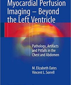 Myocardial Perfusion Imaging - Beyond the Left Ventricle: Pathology, Artifacts and Pitfalls in the Chest and Abdomen 1st ed. 2017 Edition