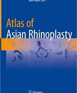 Atlas of Asian Rhinoplasty 1st ed. 2018 Edition PDF