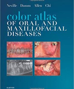 Color Atlas of Oral and Maxillofacial Diseases 1st Edition PDF