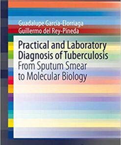 Practical and Laboratory Diagnosis of Tuberculosis: From Sputum Smear to Molecular Biology (SpringerBriefs in Microbiology)