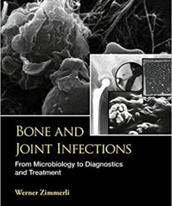 Bone and Joint Infections: From Microbiology to Diagnostics and Treatment 1st Edition