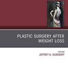 Plastic Surgery After Weight Loss , An Issue of Clinics in Plastic Surgery (The Clinics: Surgery) PDF