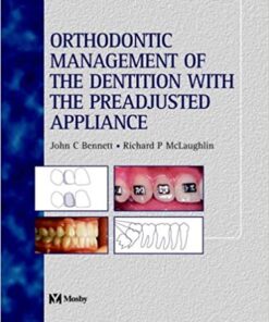 Orthodontic Management of the Dentition with the Pre-adjusted Appliance PDF