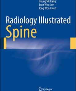 Radiology Illustrated: Spine 2014 Edition PDF