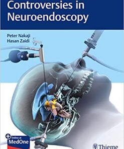 Controversies in Neuroendoscopy PDF