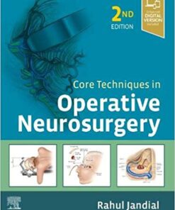 Core Techniques in Operative Neurosurgery 2nd Edition PDF & Video