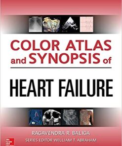 Color Atlas and Synopsis of Heart Failure 1st Edition PDF