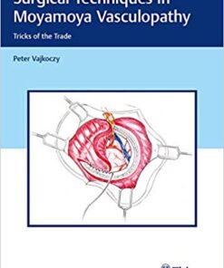 Surgical Techniques in Moyamoya Vasculopathy: Tricks of the Trade 1st Edition PDF