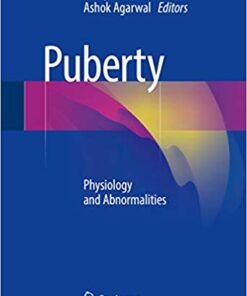 Puberty: Physiology and Abnormalities 1st ed. 2016 Edition