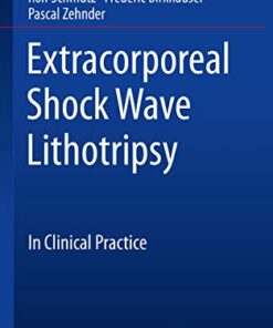 Extracorporeal Shock Wave Lithotripsy: In Clinical Practice