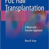 FUE Hair Transplantation: A Minimally Invasive Approach 1st ed. 2019 Edition