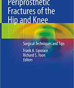 Periprosthetic Fractures of the Hip and Knee: Surgical Techniques and Tips 1st ed. 2019 Edition