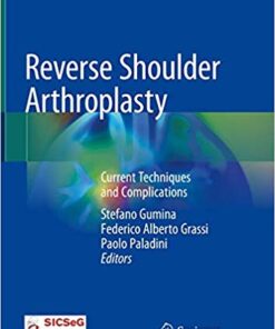 Reverse Shoulder Arthroplasty: Current Techniques and Complications 1st ed. 2019 Edition