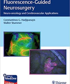 Fluorescence-Guided Neurosurgery: Neuro-oncology and Cerebrovascular Applications 1st Edition