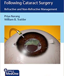 Optimizing Suboptimal Results Following Cataract Surgery: Refractive and Non-Refractive Management 1st Edition