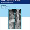 Surgery of the Thoracic Spine: Principles and Techniques 1st Edition