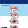 The Glioma Book 1st Edition PDF