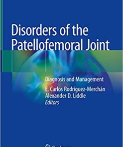 Disorders of the Patellofemoral Joint: Diagnosis and Management 1st ed. 2019 Edition PDF