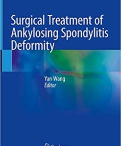 Surgical Treatment of Ankylosing Spondylitis Deformity 1st ed. 2019 Edition PDF