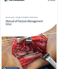 Manual of Fracture Management - Wrist 1st Edition PDF