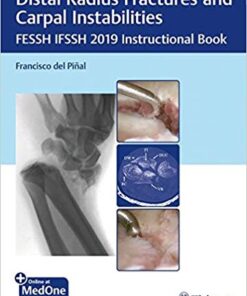 Distal Radius Fractures and Carpal Instabilities: FESSH IFSSH 2019 Instructional Book 1st Edition PDF