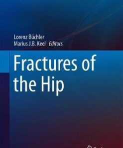 Fractures of the Hip (Fracture Management Joint by Joint) 1st ed. 2019 Edition PDF