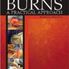 Burns: A Practical Approach to Immediate Treatment and Long Term Care 1st Edition PDF