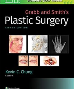 Grabb and Smith's Plastic Surgery Eighth Edition PDF