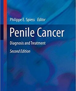 Penile Cancer: Diagnosis and Treatment (Current Clinical Urology) 2nd ed. 2017 Edition PDF