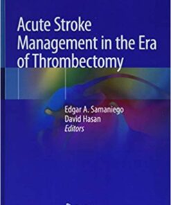 Acute Stroke Management in the Era of Thrombectomy 1st ed. 2019 Edition PDF