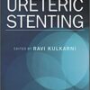 Ureteric Stenting 1st Edition PDF