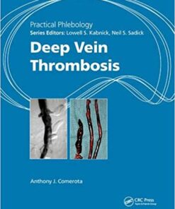 Practical Phlebology: Deep Vein Thrombosis 1st Edition PDF