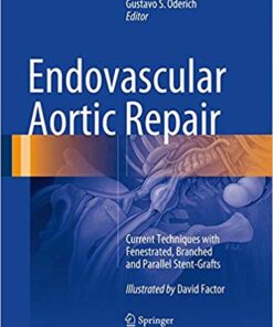 Endovascular Aortic Repair: Current Techniques with Fenestrated, Branched and Parallel Stent-Grafts 1st ed. 2017 Edition PDF