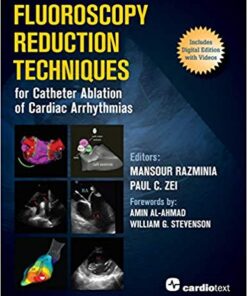 Fluoroscopy Reduction Techniques for Catheter Ablation of Cardiac Arrhythmias 1st Edition PDF