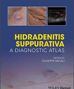 Hidradenitis Suppurativa: A Diagnostic Atlas 1st Edition PDF