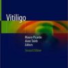 Vitiligo 2nd ed. 2019 Edition PDF