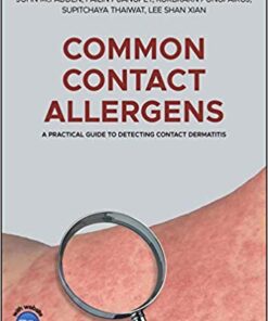 Common Contact Allergens: A Practical Guide to Detecting Contact Dermatitis 1st Edition PDF