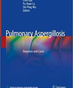 Pulmonary Aspergillosis: Diagnosis and Cases 1st ed. 2019 Edition PDF