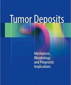 Tumor Deposits: Mechanism, Morphology and Prognostic Implications 1st ed. 2018 Edition PDF