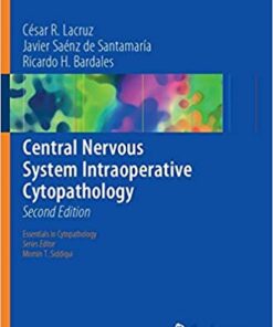 Central Nervous System Intraoperative Cytopathology (Essentials in Cytopathology) 2nd ed. 2018 Edition PDF