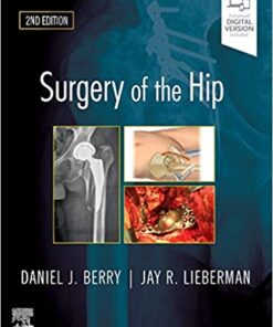 Surgery of the Hip 2nd Edition PDF