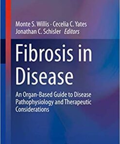 Fibrosis in Disease: An Organ-Based Guide to Disease Pathophysiology and Therapeutic Considerations (Molecular and Translational Medicine) 1st ed. 2019 Edition PDF