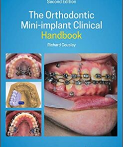 The Orthodontic Mini-implant Clinical Handbook 2nd Edition  PDF