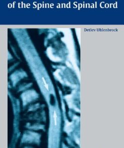 MR Imaging of the Spine and Spinal Cord 1st Edition by Detlev Uhlenbrock  (Author)