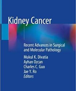 Kidney Cancer: Recent Advances in Surgical and Molecular Pathology 1st ed. 2020 Edition PDF