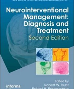 Neurointerventional Management: Diagnosis and Treatment, Second Edition 2nd Edition PDF